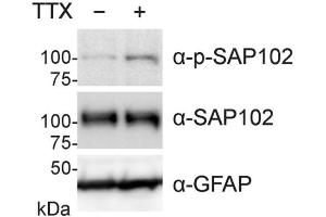 TTX treatment (2 μM, O/N) of primary rat hippocampal neuron cultures (DIV23) increases SAP102 phosphorylation, as observable by Western blot with the phospho-specific SAP102 antibody (α-p-SAP102).