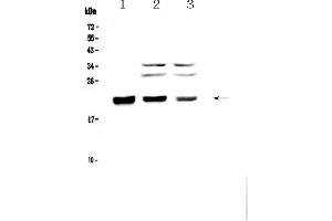 Western blot analysis of CBFb using anti-CBFb antibody . (CBFB Antikörper  (AA 1-182))