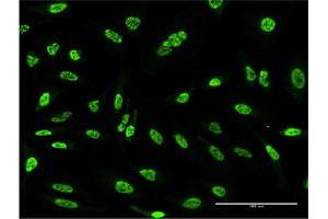 Immunofluorescence of monoclonal antibody to OXSR1 on HeLa cell. (OXSR1 Antikörper  (AA 351-450))
