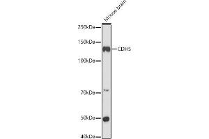 Western blot analysis of extracts of Mouse brain, using CDH5 antibody (ABIN6134029, ABIN6138297, ABIN6138298 and ABIN6216033) at 1:1000 dilution. (Cadherin 5 Antikörper  (AA 650-750))
