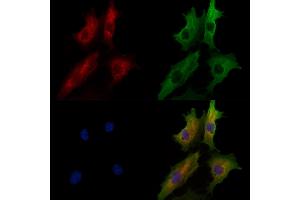 ABIN7094611 and ABIN7098661 staining  cells by IF/ICC. (ANTXR1 Antikörper  (Internal Region))
