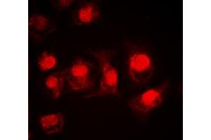Immunofluorescent analysis of MSK1 staining in HEK293T cells. (MSK1 Antikörper  (Center))