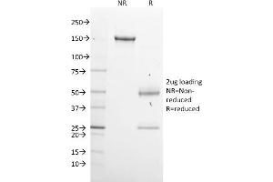 SDS-PAGE Analysis Purified GPN1 Mouse Monoclonal Antibody (GPN1/2350). (GPN1 Antikörper)