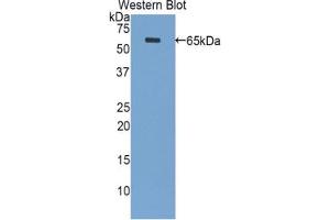 Western blot analysis of the recombinant protein. (PPL Antikörper  (AA 1439-1716))