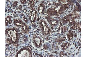 Immunohistochemical staining of paraffin-embedded Human breast tissue using anti-ACBD3 mouse monoclonal antibody.