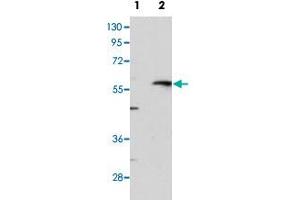 Western blot analysis of MMP13 (arrow) using MMP13 polyclonal antibody . (MMP13 Antikörper  (C-Term))