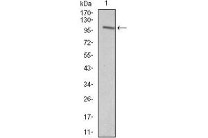 Western blot analysis using VAV1 antibody against HEK293 (1) and VAV1 (AA: 121-324) -hIgGFc transfected HEK293 (2) cell lysate. (VAV1 Antikörper  (AA 121-324))