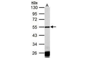 Image no. 2 for anti-Calsequestrin 1 (CASQ1) (AA 136-381) antibody (ABIN1501918) (Calsequestrin Antikörper  (AA 136-381))