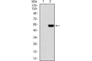 Western blot analysis using EZR mAb against HEK293 (1) and EZR (AA: 292-464)-hIgGFc transfected HEK293 (2) cell lysate. (Ezrin Antikörper  (AA 292-464))