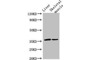 Western Blot Positive WB detected in: Mouse liver tissue, Mouse skeletal muscle tissue All lanes: LYVE1 antibody at 3 μg/mL Secondary Goat polyclonal to rabbit IgG at 1/50000 dilution Predicted band size: 36 kDa Observed band size: 36 kDa (LYVE1 Antikörper  (AA 20-238))