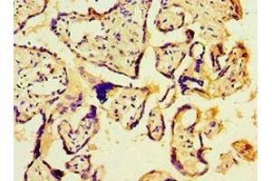Immunohistochemistry (IHC) image for anti-PDZ Binding Kinase (PBK) (AA 1-322) antibody (ABIN7158664)
