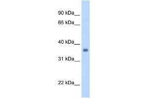 SGCG antibody used at 1.