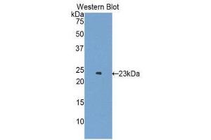 Western Blotting (WB) image for anti-Erythropoietin Receptor (EPOR) (AA 45-244) antibody (ABIN3209698) (EPOR Antikörper  (AA 45-244))