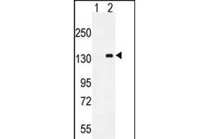 Western blot analysis of CSF1R (arrow) using mouse Monoclonal CSF1R ABIN659076. (CSF1R Antikörper)