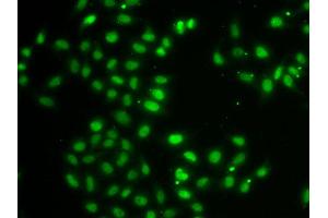 Immunofluorescence analysis of MCF7 cell using DUSP22 antibody. (DUSP22 Antikörper)