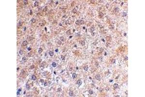 Immunohistochemistry (IHC) image for anti-Tumor Protein P53 Inducible Nuclear Protein 1 (TP53INP1) (N-Term) antibody (ABIN1031500) (TP53INP1 Antikörper  (N-Term))