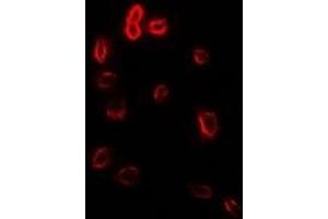 Immunofluorescent analysis of Stomatin staining in Hela cells. (Stomatin Antikörper)