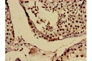 Immunohistochemistry of paraffin-embedded human testis tissue using ABIN7153811 at dilution of 1:100 (USO1 Antikörper  (AA 591-733))