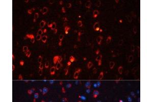 Immunofluorescence analysis of Mouse brain using KCNA1 Polyclonal Antibody at dilution of 1:100.