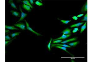 Immunofluorescence of purified MaxPab antibody to HOMER1 on HeLa cell. (HOMER1 Antikörper  (AA 1-354))