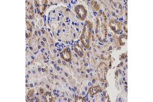 Immunohistochemistry of paraffin-embedded rat kidney using EPXH2 antibody at dilution of 1:200 (x400 lens). (EPHX2 Antikörper)