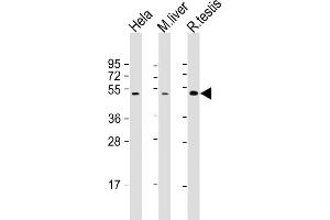 All lanes : Anti-CHRNB2 Antibody (N-Term) at 1:2000 dilution Lane 1: Hela whole cell lysate Lane 2: mouse liver lysate Lane 3: rat testis lysate Lysates/proteins at 20 μg per lane. (CHRNB2 Antikörper  (AA 66-100))