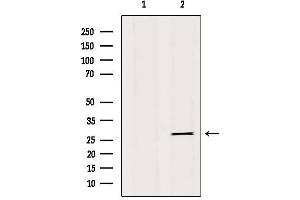 Western blot analysis of extracts from 293, using IBP4 Antibody. (IGFBP4 Antikörper  (Internal Region))