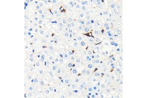 Immunohistochemistry of paraffin-embedded mouse liver using Heme Oxygenase 1 (HO-1/HMOX1) (HO-1/HMOX1) Rabbit mAb  at dilution of 1:100 (40x lens). (HMOX1 Antikörper)
