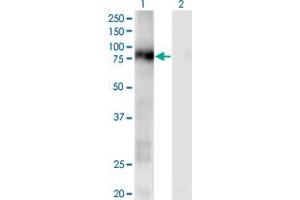 Western Blot analysis of CD93 expression in transfected 293T cell line by CD93 monoclonal antibody (M04), clone 1A4.