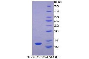 SDS-PAGE (SDS) image for Transforming Growth Factor, alpha (TGFA) (AA 42-82) protein (His tag) (ABIN1080999)