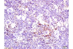 Formalin-fixed and paraffin embedded mouse spleen labeled with Rabbit Anti OPGL/RANKL/ODF Polyclonal Antibody, Unconjugated (ABIN672696) at 1:200 followed by conjugation to the secondary antibody and DAB staining (RANKL Antikörper  (AA 210-317))