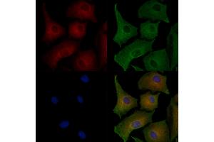 ABIN7094428 and ABIN7098476 staining  cells by IF/ICC.
