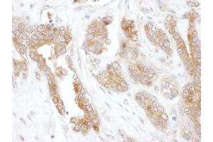 Immunohistochemistry (IHC) image for anti-Chaperonin Containing TCP1, Subunit 5 (Epsilon) (CCT5) (AA 100-150) antibody (ABIN7453616) (CCT5 Antikörper  (AA 100-150))