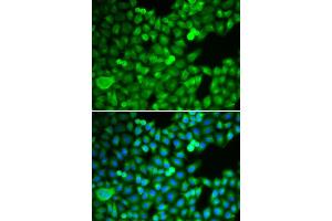 Immunofluorescence (IF) image for anti-Proteasome (Prosome, Macropain) Subunit, beta Type, 5 (PSMB5) (AA 1-263) antibody (ABIN3022702)