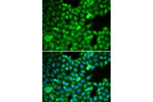 Immunofluorescence analysis of MCF-7 cell using PSMB5 antibody. (PSMB5 Antikörper  (AA 1-263))