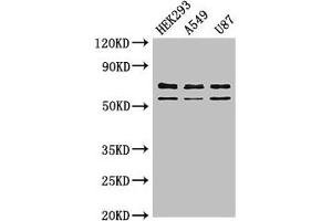 Western Blot Positive WB detected in: HEK293 whole cell lysate, A549 whole cell lysate, U87 whole cell lysate All lanes: CPZ antibody at 3 μg/mL Secondary Goat polyclonal to rabbit IgG at 1/50000 dilution Predicted band size: 74 kDa Observed band size: 74, 59 kDa (CPZ Antikörper  (AA 21-652))