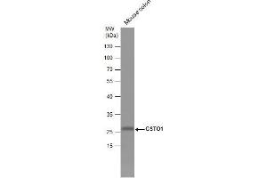 WB Image Mouse tissue extract (50 μg) was separated by 12% SDS-PAGE, and the membrane was blotted with GSTO1 antibody [N1C3] , diluted at 1:1000. (GSTO1 Antikörper)