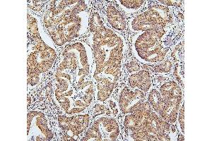 IHC analysis of SAE2/UBA2 using anti-SAE2/UBA2 antibody (ABIN7601755).