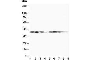 Western blot testing of MEK3 antibody and Lane 1:  rat spleen;  2: rat thymus;  3: rat skeletal muscle;  4: rat kidney, and human samples  5: MCF-7;  6: HeLa;  7: Raji;  8: CEM;  9: COLO320 cell lysate