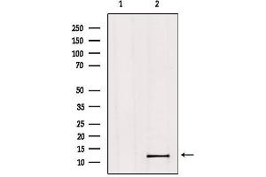 Western blot analysis of extracts from Hela, using MED11 Antibody. (MED11 Antikörper  (Internal Region))