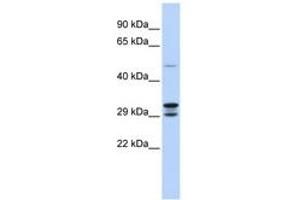 Image no. 1 for anti-Chromosome 14 Open Reading Frame 166 (C14orf166) (N-Term) antibody (ABIN6742833)