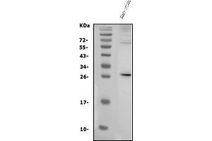 Western blot analysis of IL3 using anti-IL3 antibody (ABIN7602653).