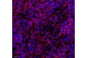 Immunofluorescence (Paraffin-embedded Sections) (IF (p)) image for anti-La Ribonucleoprotein Domain Family, Member 1 (LARP1) antibody (ABIN7074453)