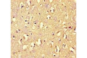 Immunohistochemistry of paraffin-embedded human brain tissue using ABIN7167960 at dilution of 1:100 (ARHGAP42 Antikörper  (AA 541-728))