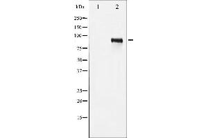Western Blotting (WB) image for anti-Insulin-Like Growth Factor 1 Receptor (IGF1R) (pTyr1161) antibody (ABIN6256620)