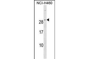 Western blot analysis in NCI-H460 cell line lysates (35ug/lane). (rala Antikörper  (C-Term))