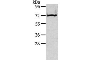 Western Blot analysis of Mouse kidney tissue using CPT2 Polyclonal Antibody at dilution of 1:200 (CPT2 Antikörper)