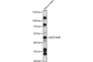 Western blot analysis of extracts of Mouse brain, using DCSTAMP antibody (ABIN7270939) at 1:3000 dilution. (Transmembrane 7 Superfamily Member 4 (TM7SF4) (AA 401-470) Antikörper)