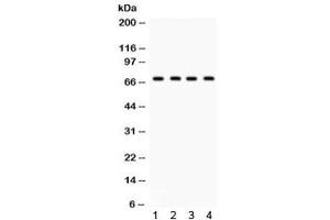 Western blot testing of 1) rat lung, human 2) HeLa, 3) HepG2 and 4) SMMC lysate with GRK5 antibody.