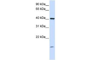 TMEM79 antibody used at 1 ug/ml to detect target protein. (TMEM79 Antikörper  (C-Term))